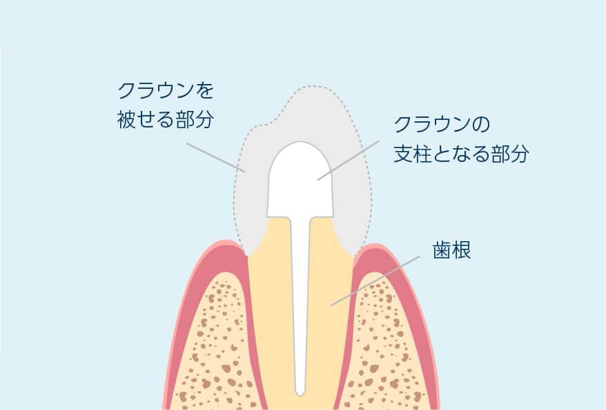 歯周組織の構造を診る