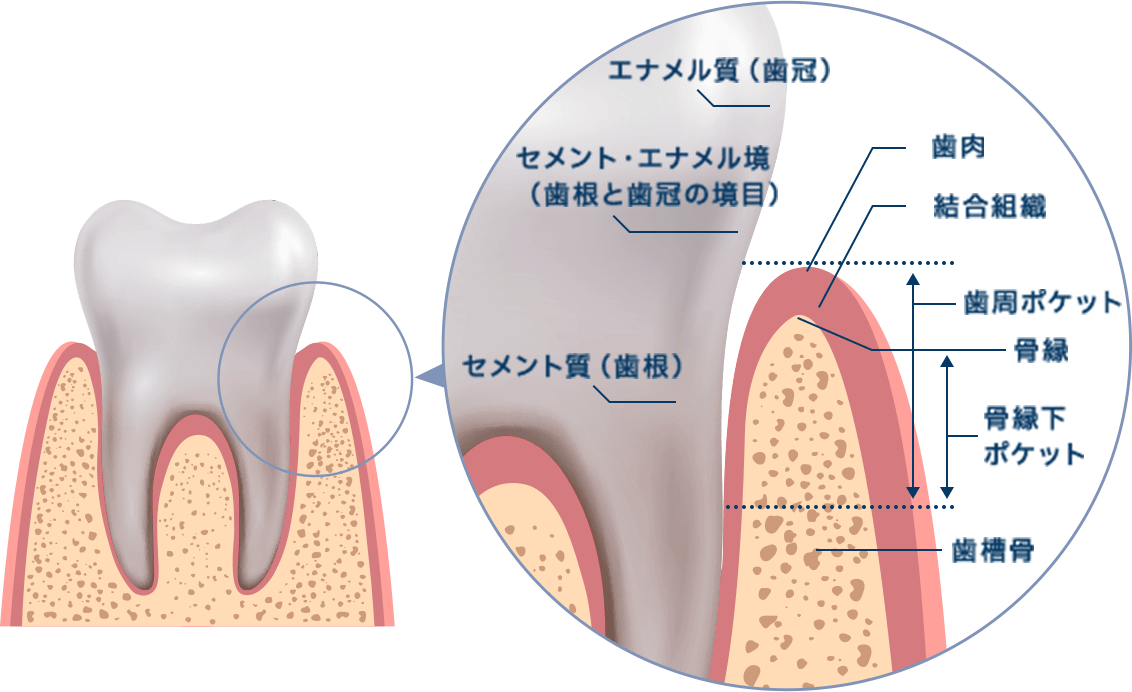 歯周組織再生療法