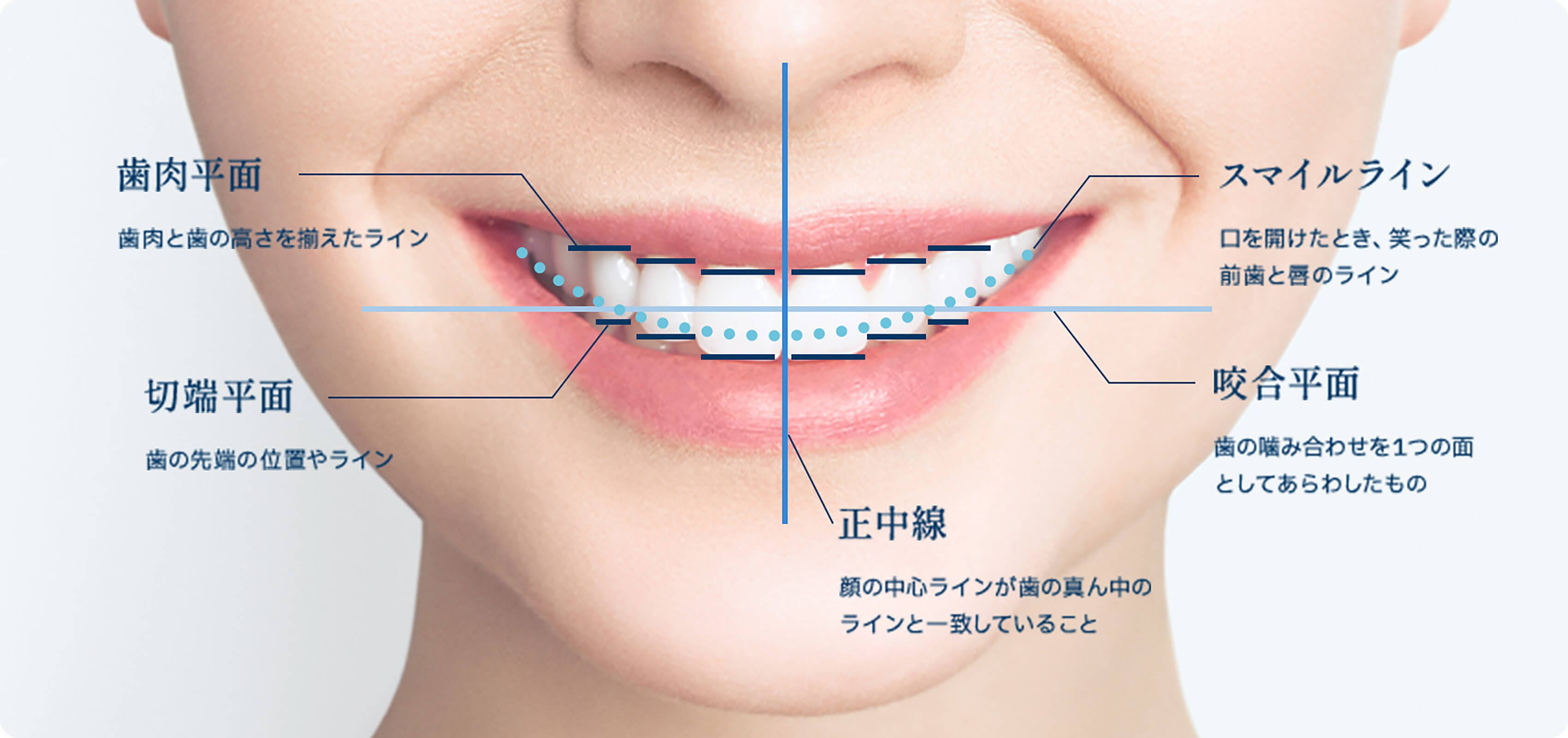 歯・歯肉・噛み合わせのラインを揃える